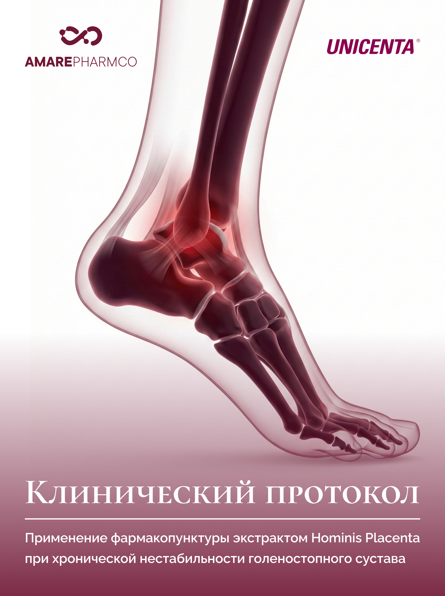 Травмы связок
